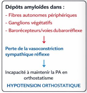 hypotension-othostatique-amylose-cardiaque