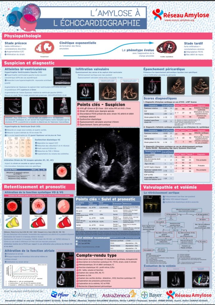 echocardiographie-amylose