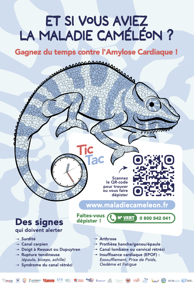 grand-jeu-cameleon